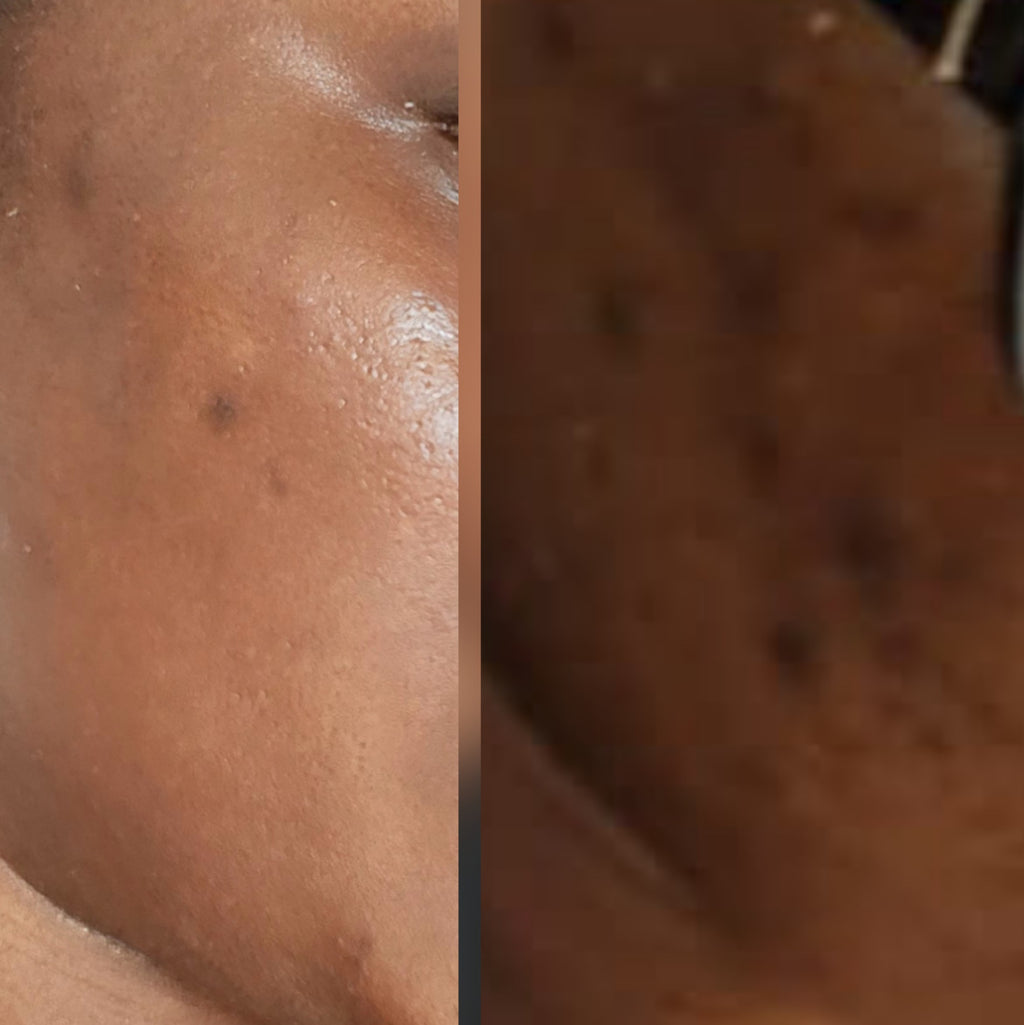Résultat avant/après application du masque GLOW
