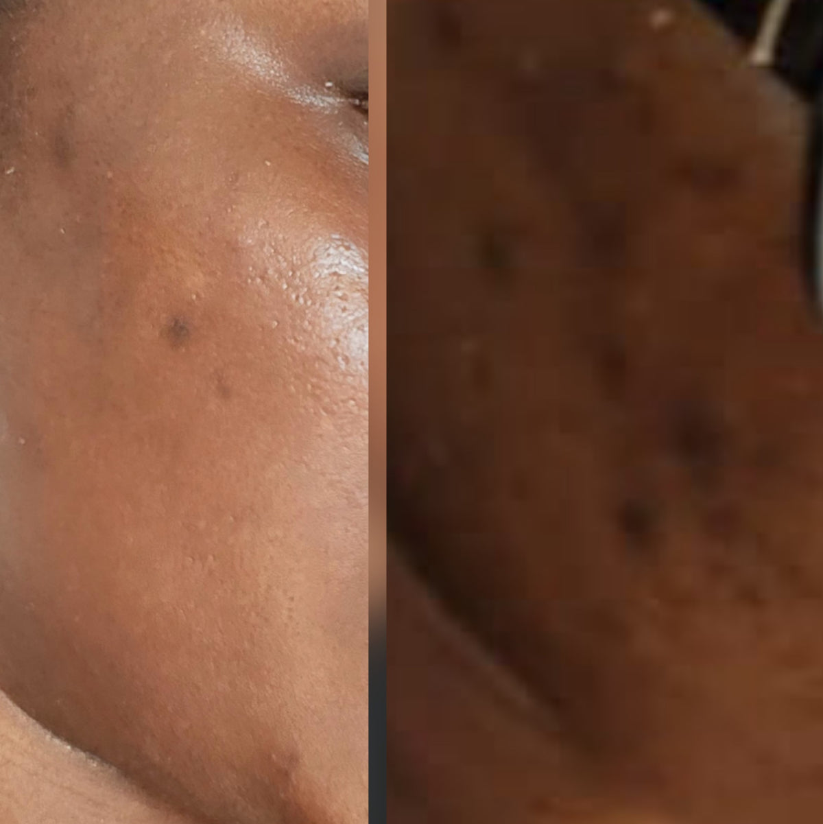 Résultat avant/après application du masque GLOW