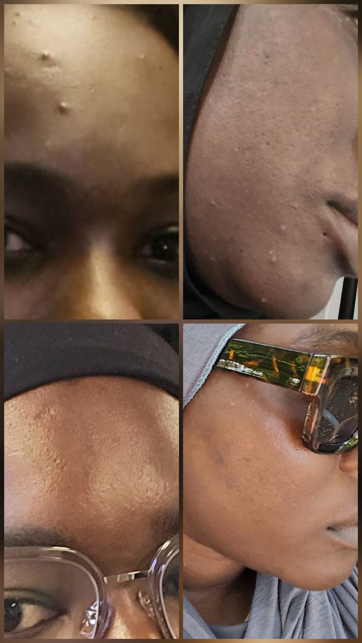 Conseils d'utilisation du masque en poudre PURE Pexey Yaay